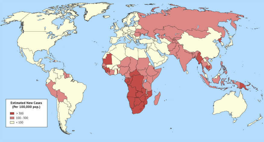 Map of areas with global tuberculosis